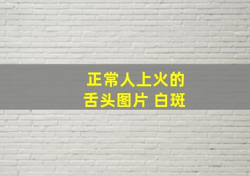 正常人上火的舌头图片 白斑